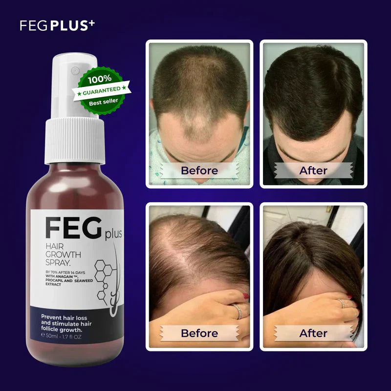 FEG™ PLUS | أكثر بخاخات نمو الشعر شهرة