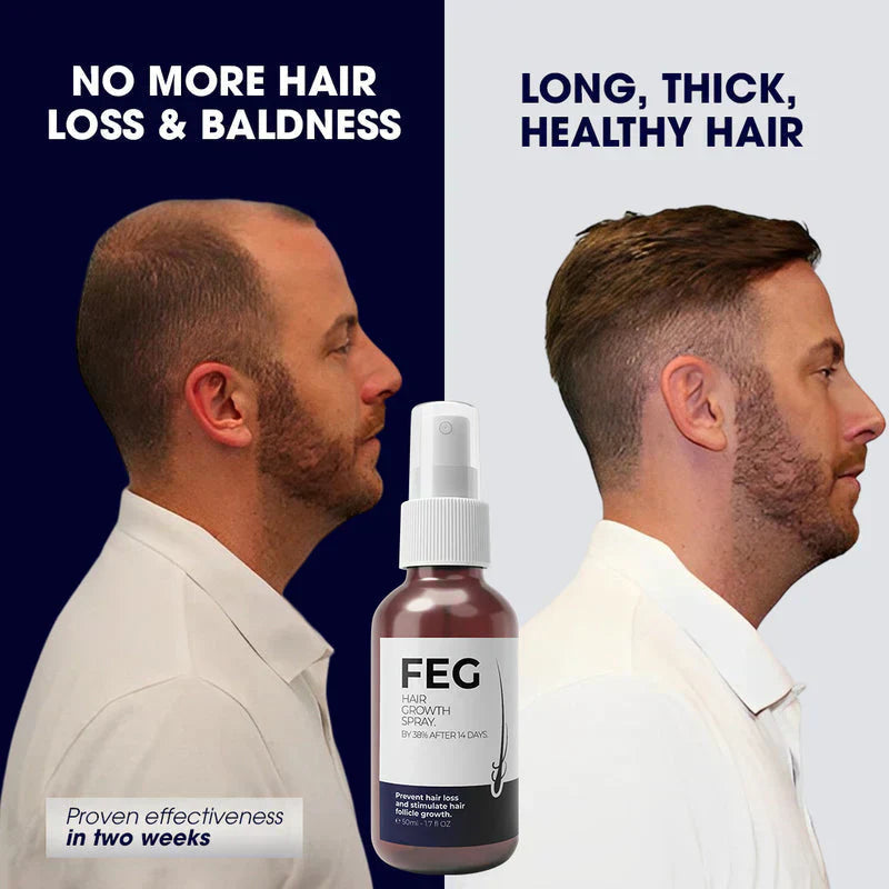 FEG™ PLUS | أكثر بخاخات نمو الشعر شهرة
