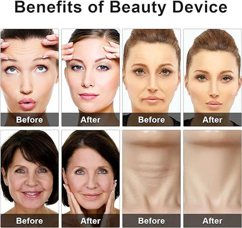 جهاز تجميل العينين - Eye Beauty Device