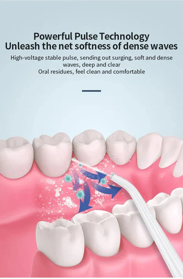 جهاز تنظيف الفم جولد كريست – Gold Crest Oral Irrigator