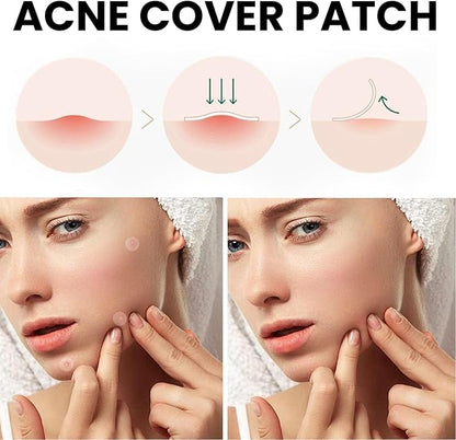 AcniFix™ Acne Cover Patch (72 Pieces)