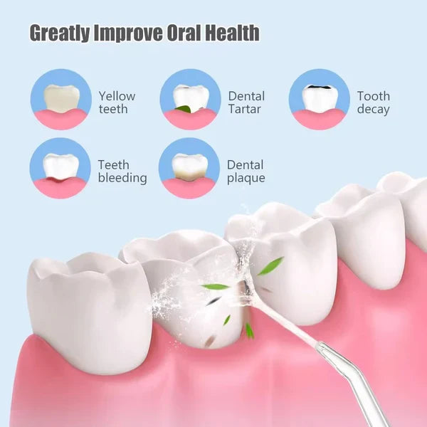 جهاز تنظيف الفم جولد كريست – Gold Crest Oral Irrigator
